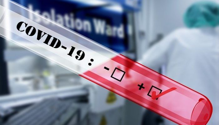 WHO Ubah Covid-19 Jadi Pandemi, UI Keluarkan Kebijakan KMB Jarak Jauh